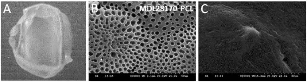 Calpain inhibitor MDL28170 locally-applied sustained-release membrane capable of promoting repairing of injured spinal cord as well as preparation method and applications of calpain inhibitor MDL28170 locally-applied sustained-release membrane