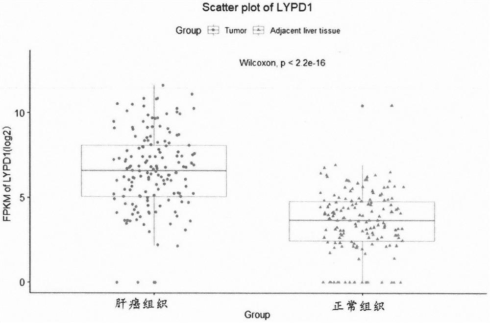 Application of LYPD1 in diagnosis, treatment, prognosis and recurrence prediction of hepatocellular carcinoma
