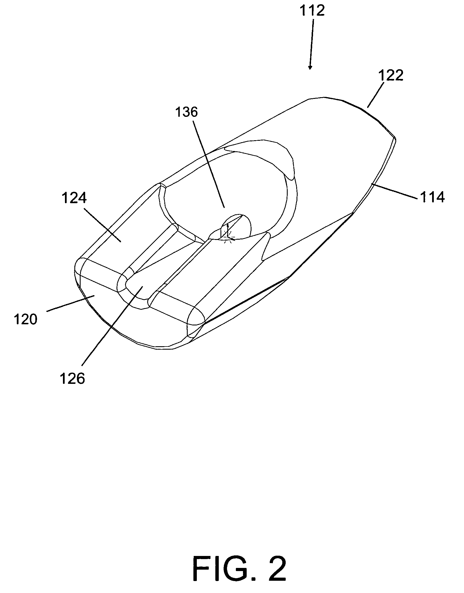 Tissue fixation system and method