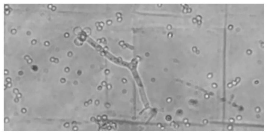 Entomogenous fungus strain with high pathogenicity to prodenia litura and application thereof