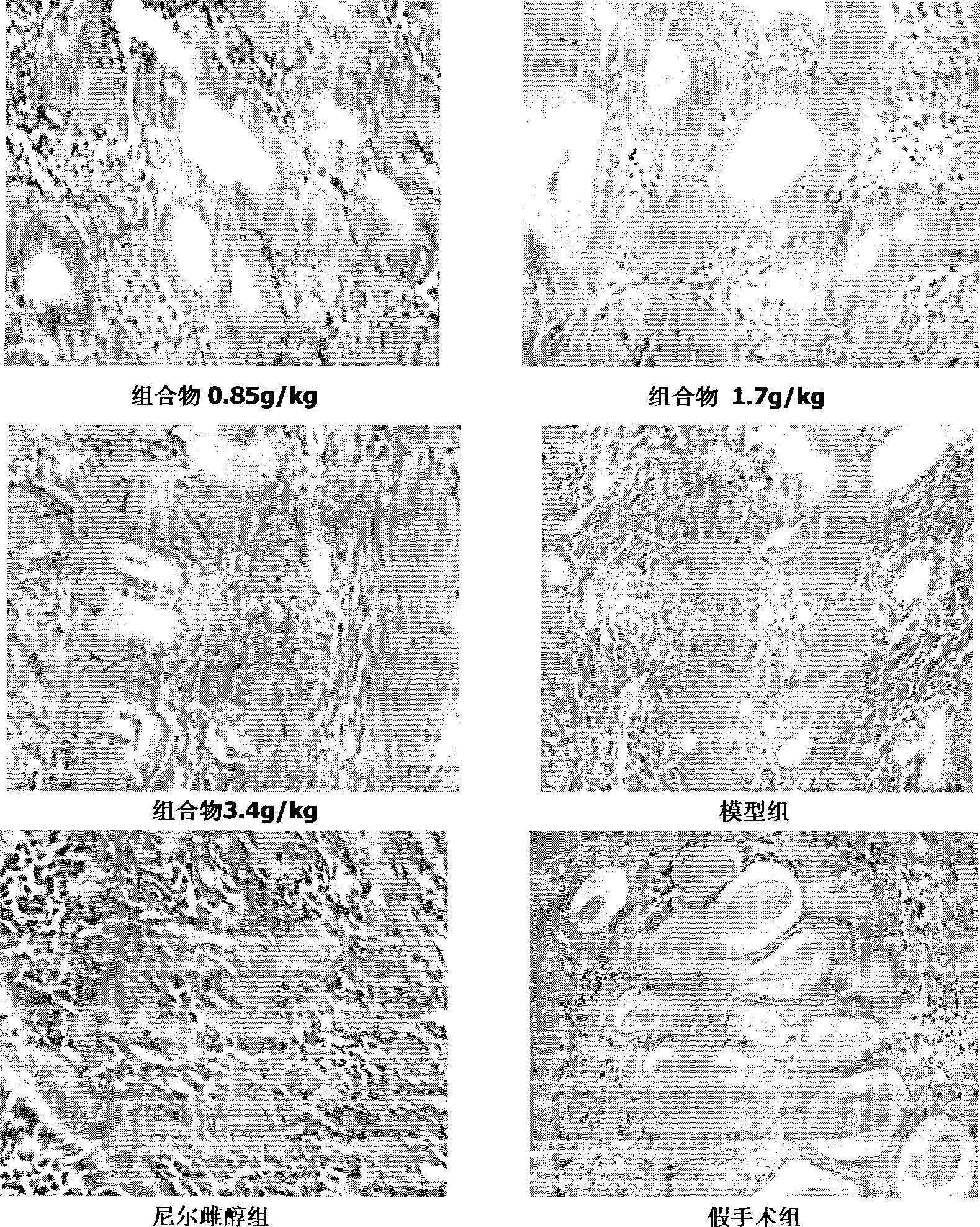 Traditional Chinese medicine composition with estrogen-like action and use thereof