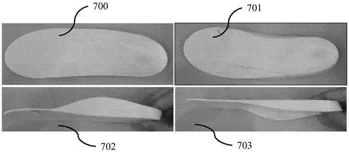 Orthopedic shoe manufacturing method and system based on pressure imaging and three-dimensional modeling technologies
