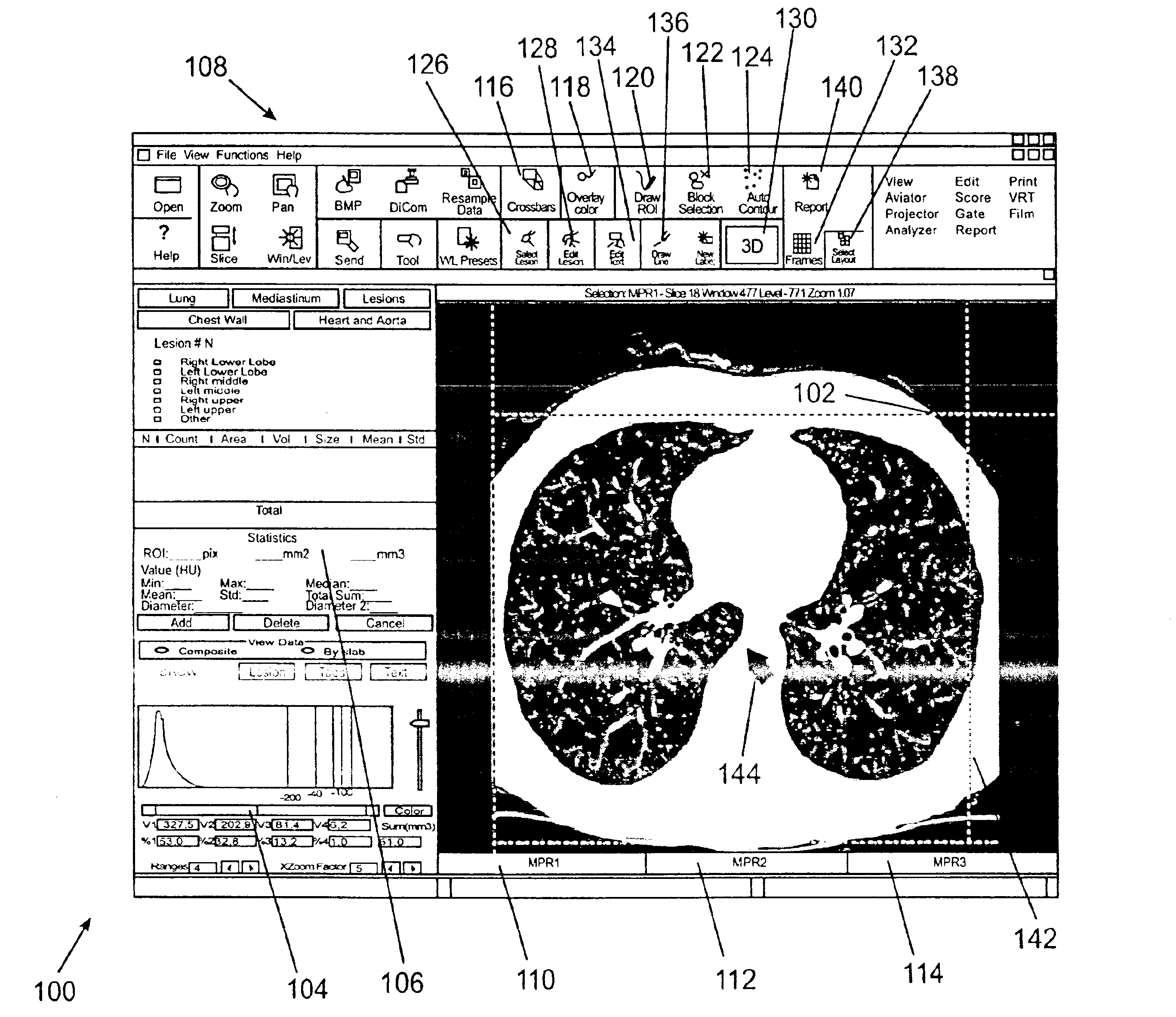 Methods for generating a lung report