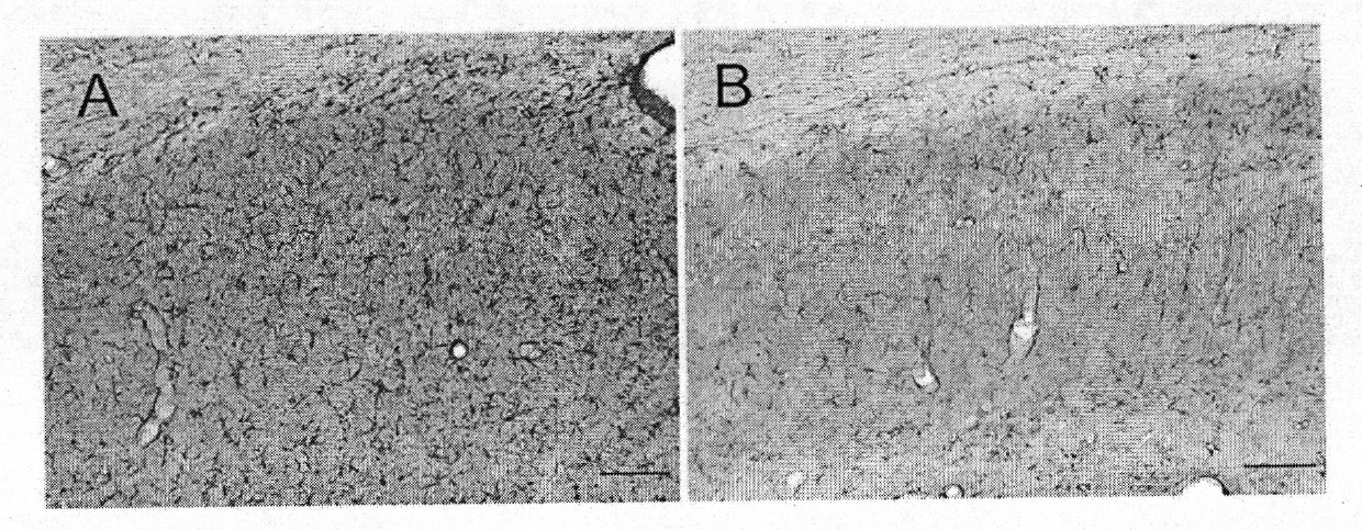 Application of panaxoside Rd in preparing medicament for preventing and curing Alzheimer's disease