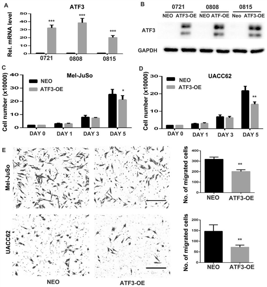 Application of dermal fibroblasts in the treatment of melanoma