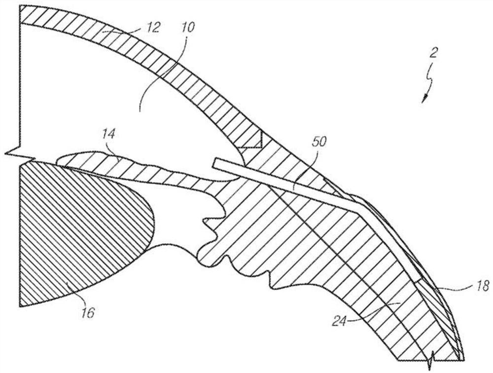 Manually adjustable intraocular flow adjustment