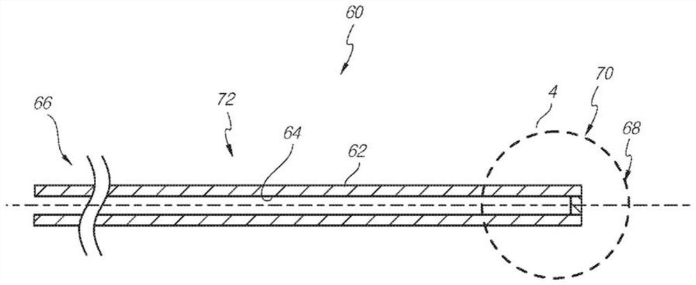 Manually adjustable intraocular flow adjustment