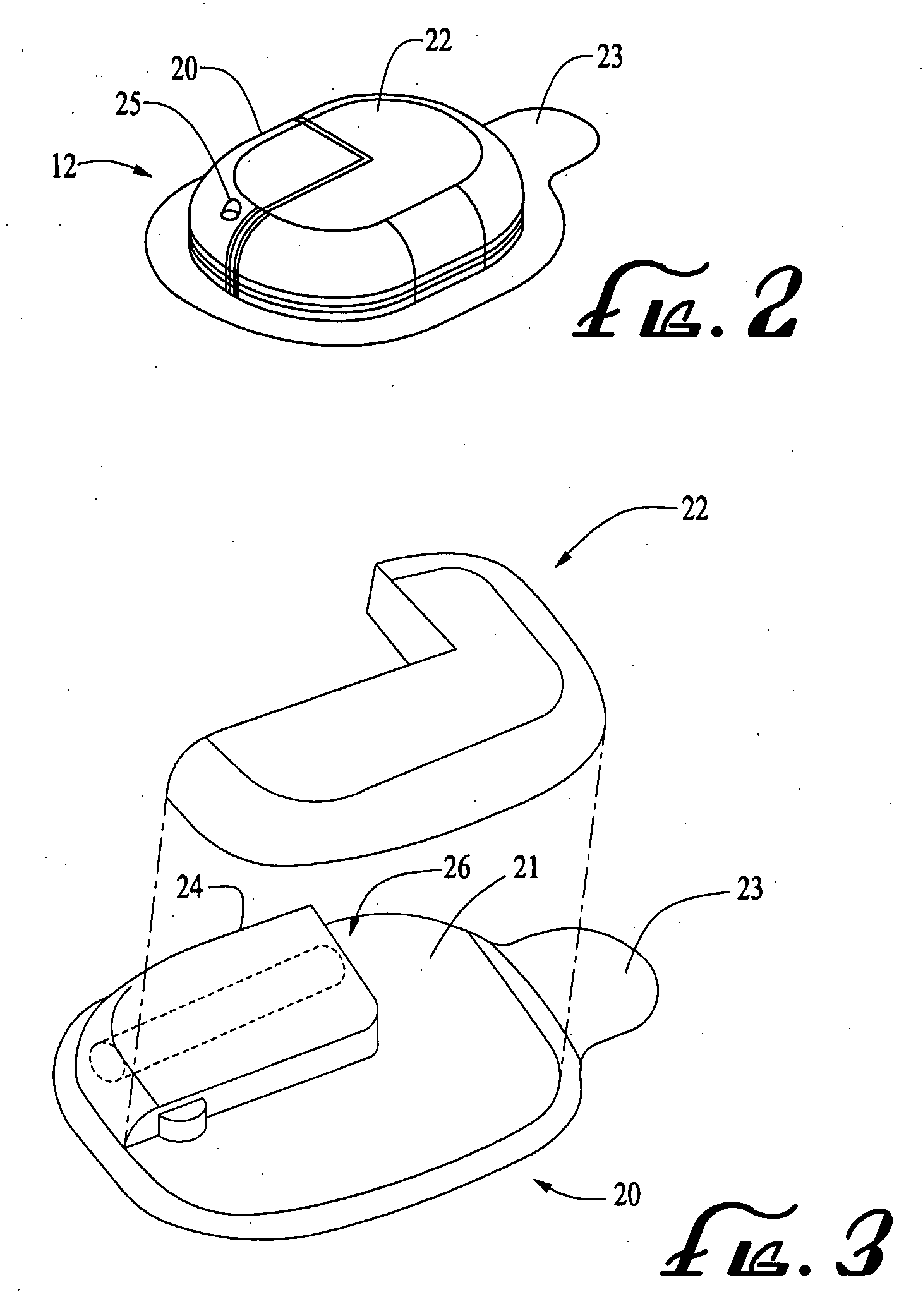 Infusion medium delivery system, device and method with needle inserter and needle inserter device and method