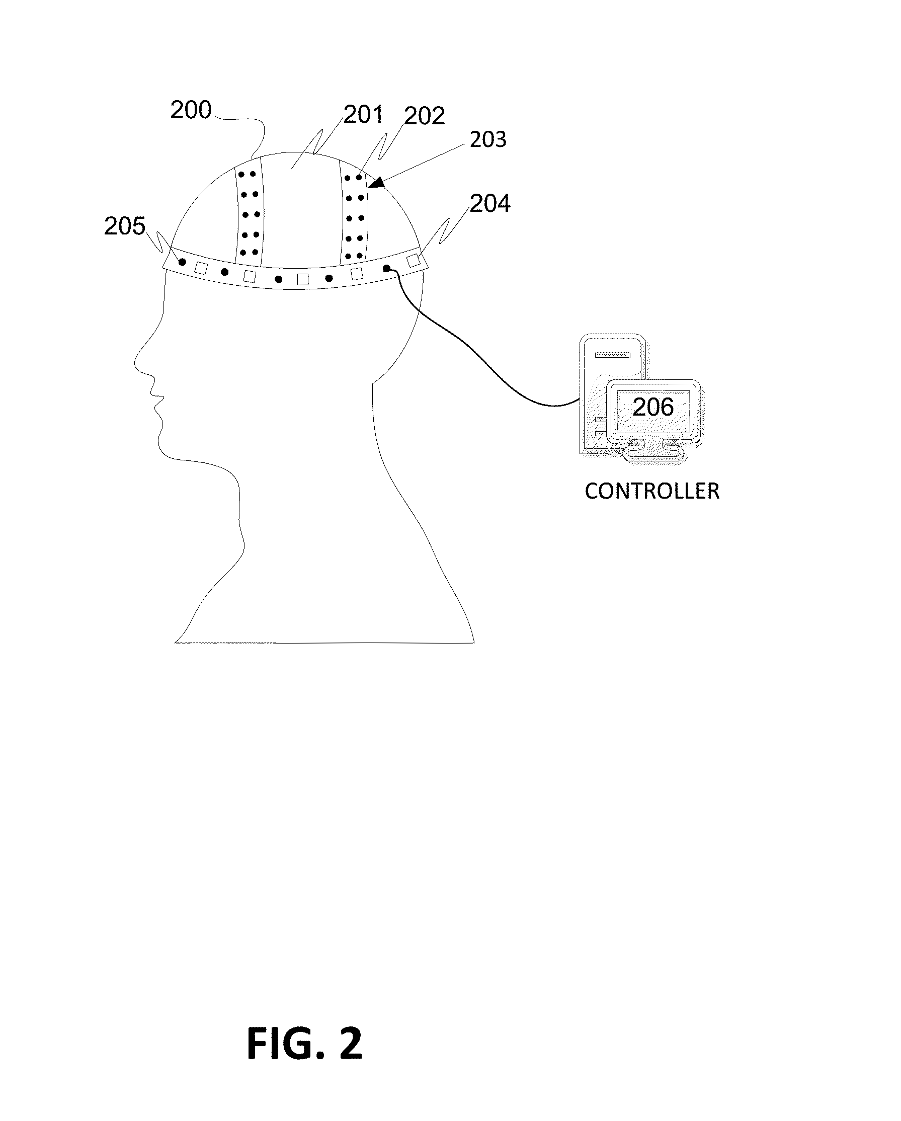 Systems and methods for directed energy cranial therapeutics