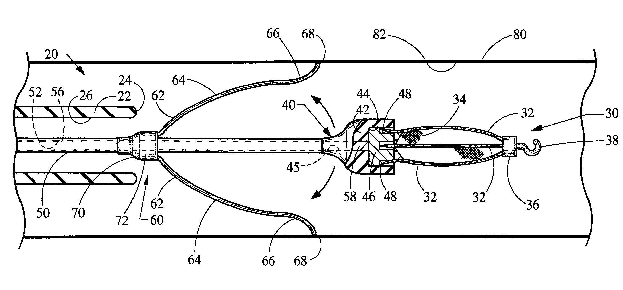 Self centering delivery catheter