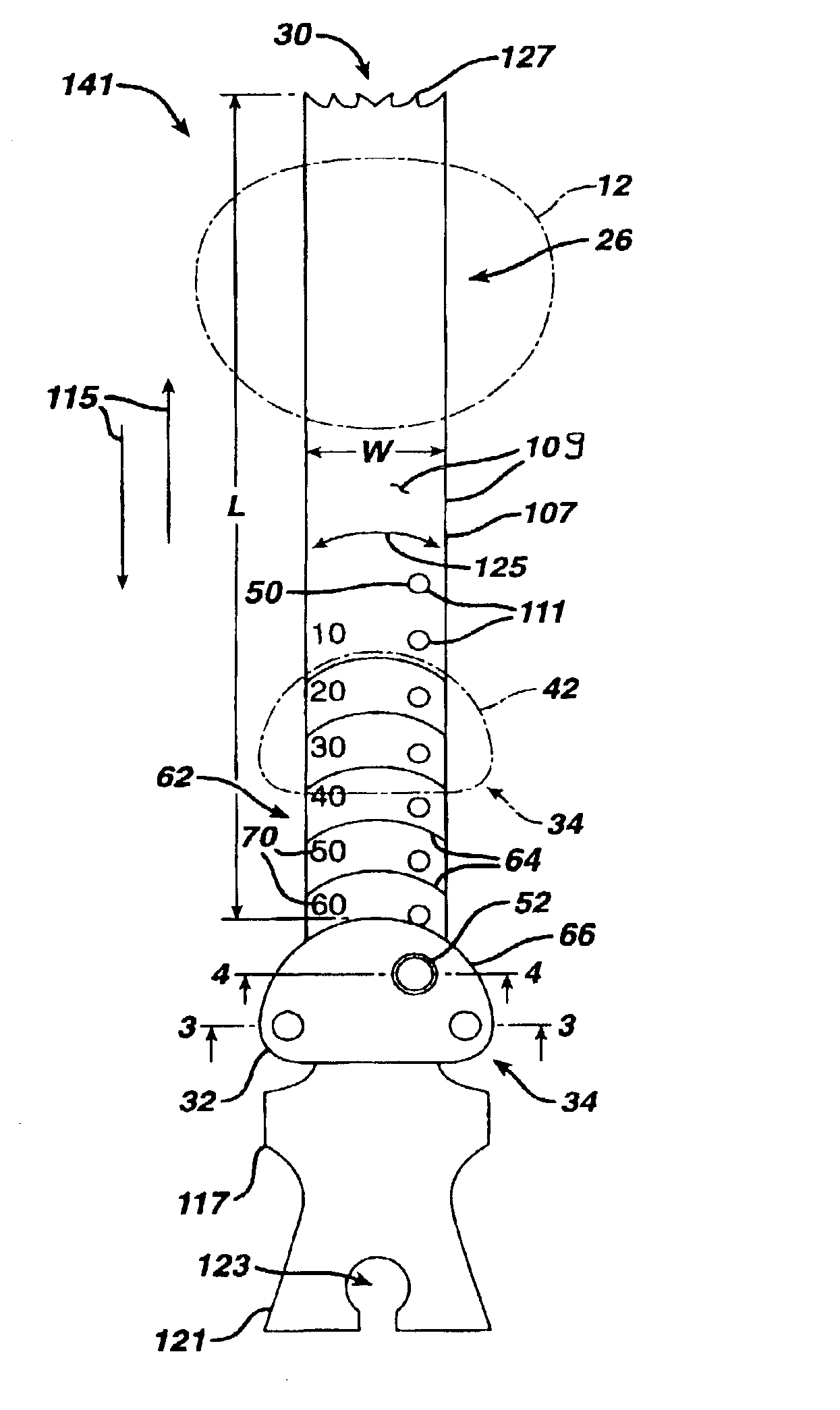 Blade for resection of bone for prosthesis implantation, blade stop and method