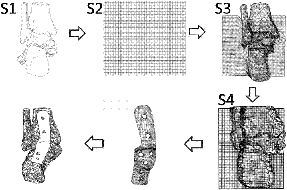 Rapid design method of personalized bone plate with controllable fitting degree