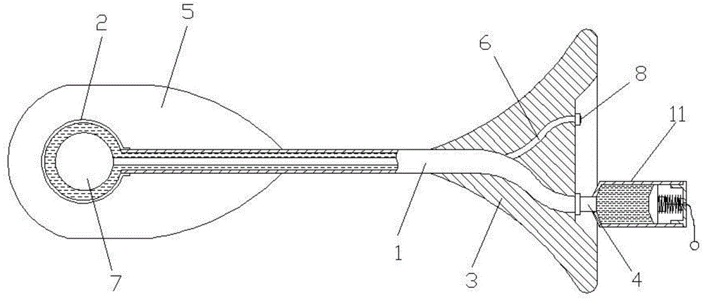 Tympanic membrane perforation subsidy repair tool