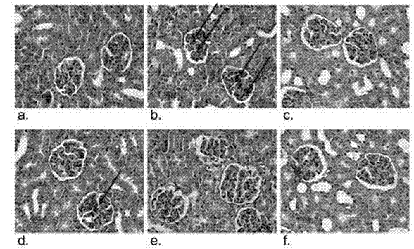 Application of compound thrombosis capsule in aspect of kidney protection