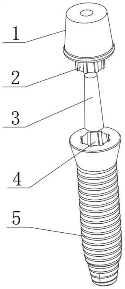 Self-expanding locking interface implant package
