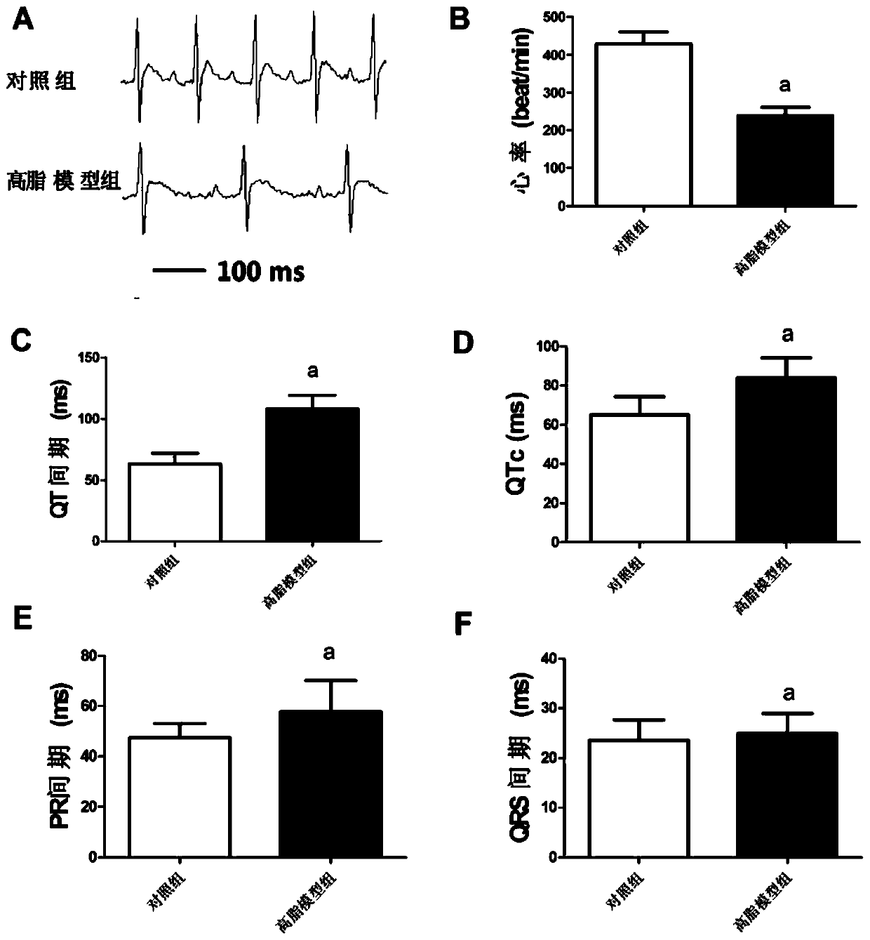 Use of aloe-emodin in the preparation of drugs for the prevention and treatment of myocardial ischemia and arrhythmia