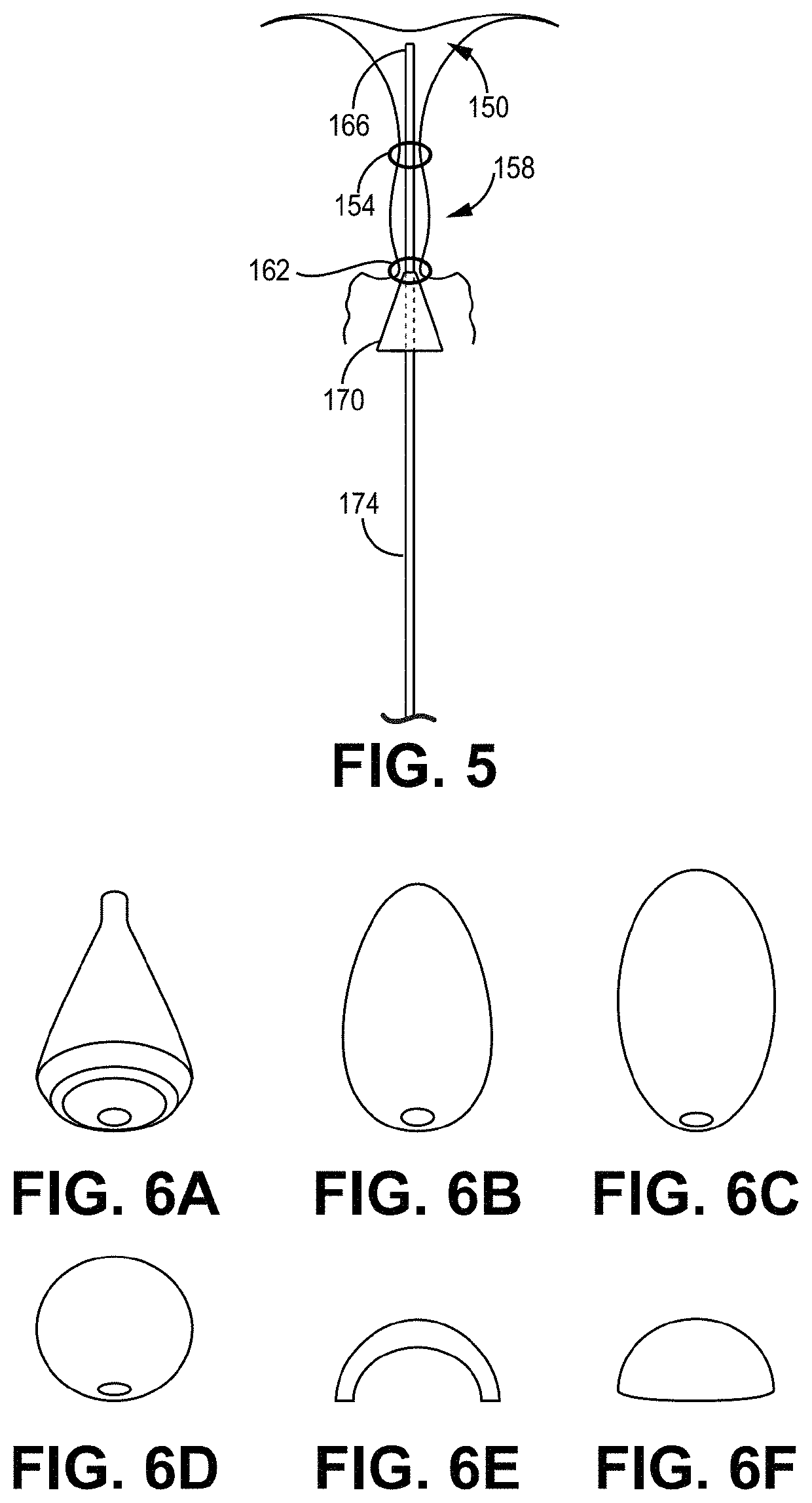 Transcervical access systems for intrauterine fluid exchange, such as placement of hydrogels formed in situ
