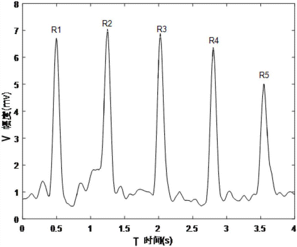 Motion state heart rate processing method and monitoring device