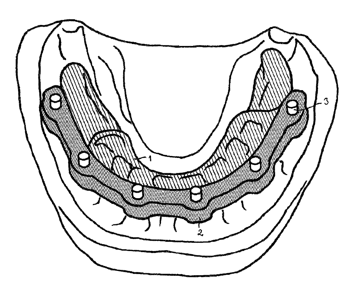 Method for producing a dental drilling template