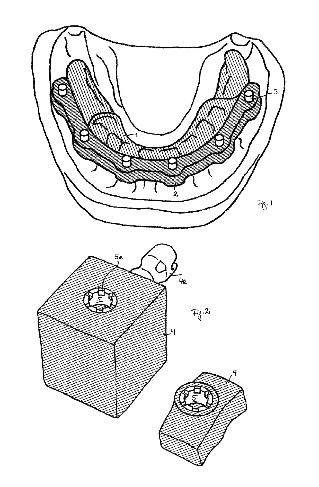 Method for producing a dental drilling template