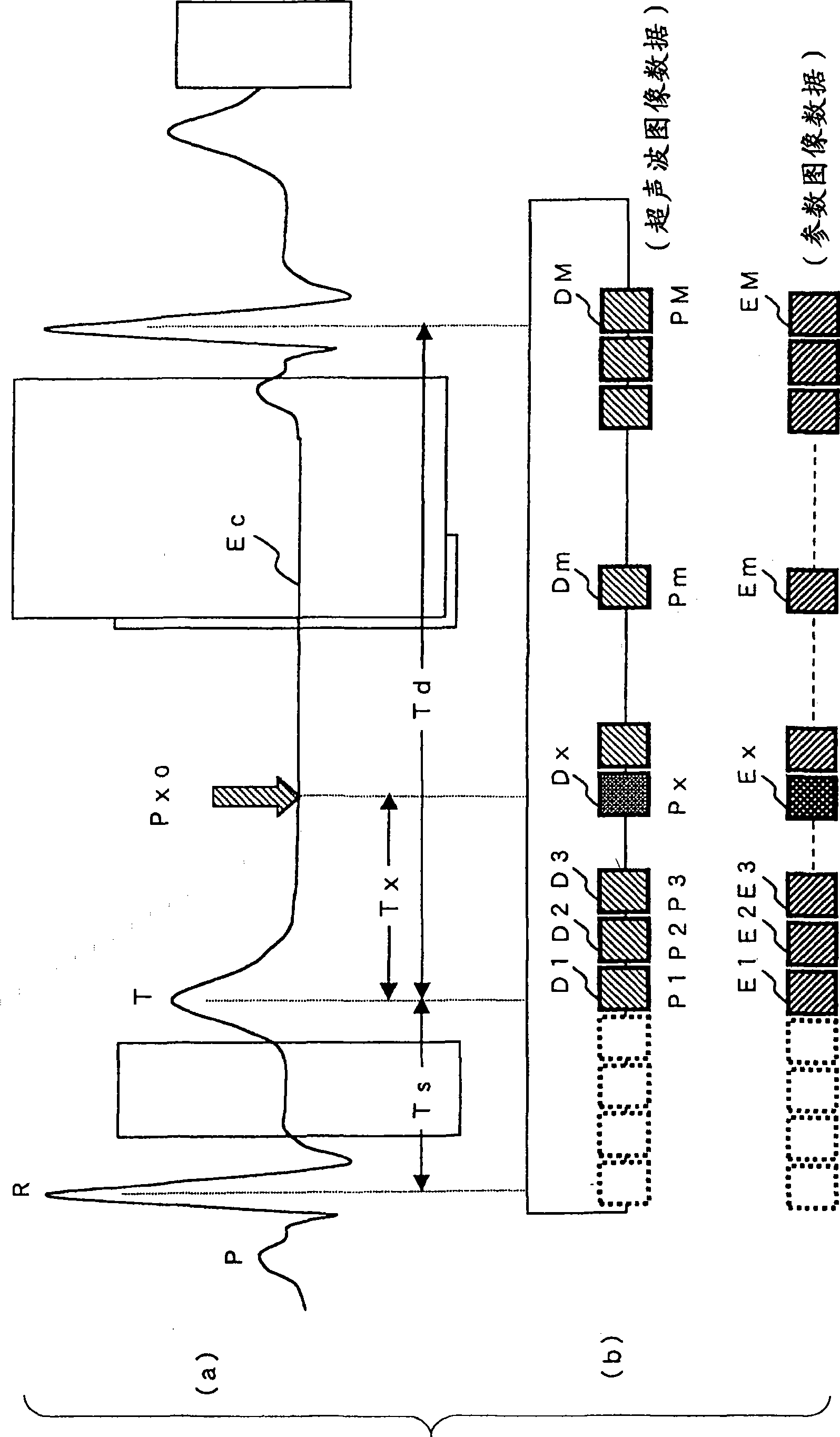 Ultrasonic diagnosis device, ultrasonic image analysis device, and ultrasonic image analysis method