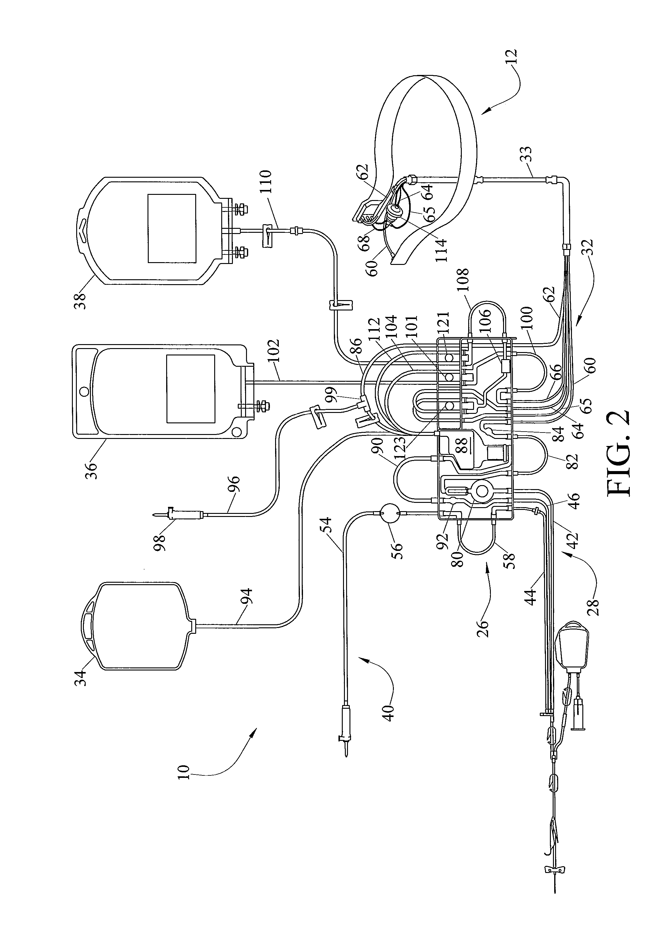 System for Blood Separation with Side-Tapped Separation Chamber