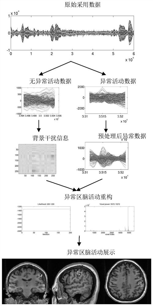 Bayesian-based imaging system for children brain lesion area with abnormal activity