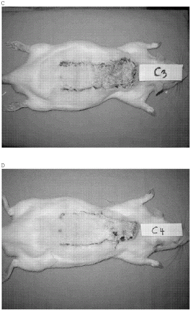 Oxabicycloheptanes and oxabicycloheptenes for the treatment of reperfusion injury