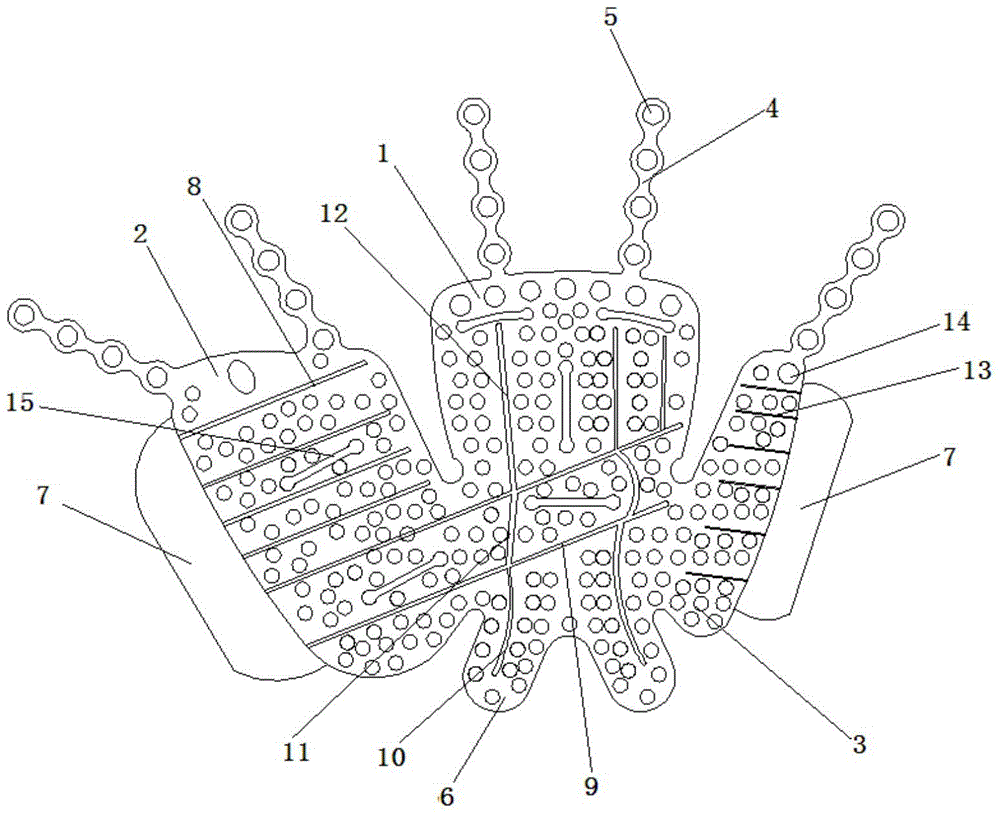 Special-shaped bone fracture plate for injury of skeleton at orbit position