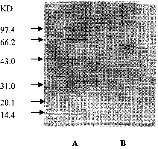 Composition of pulmonary surfactant extract and pulmonary surfactant-associated protein A, preparation method and pharmaceutical application thereof