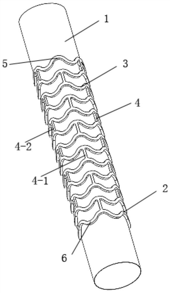 Intravascular stent structure