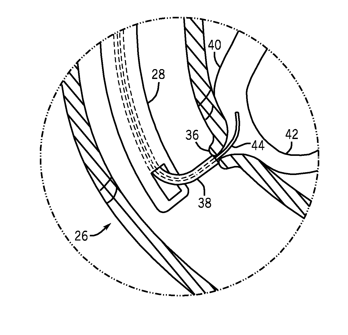 Methods and apparatuses for endoscopic retrograde cholangiopancreatography