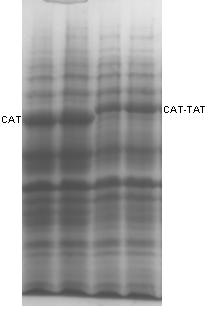 Gene for coding catalase as well as preparation method and application thereof