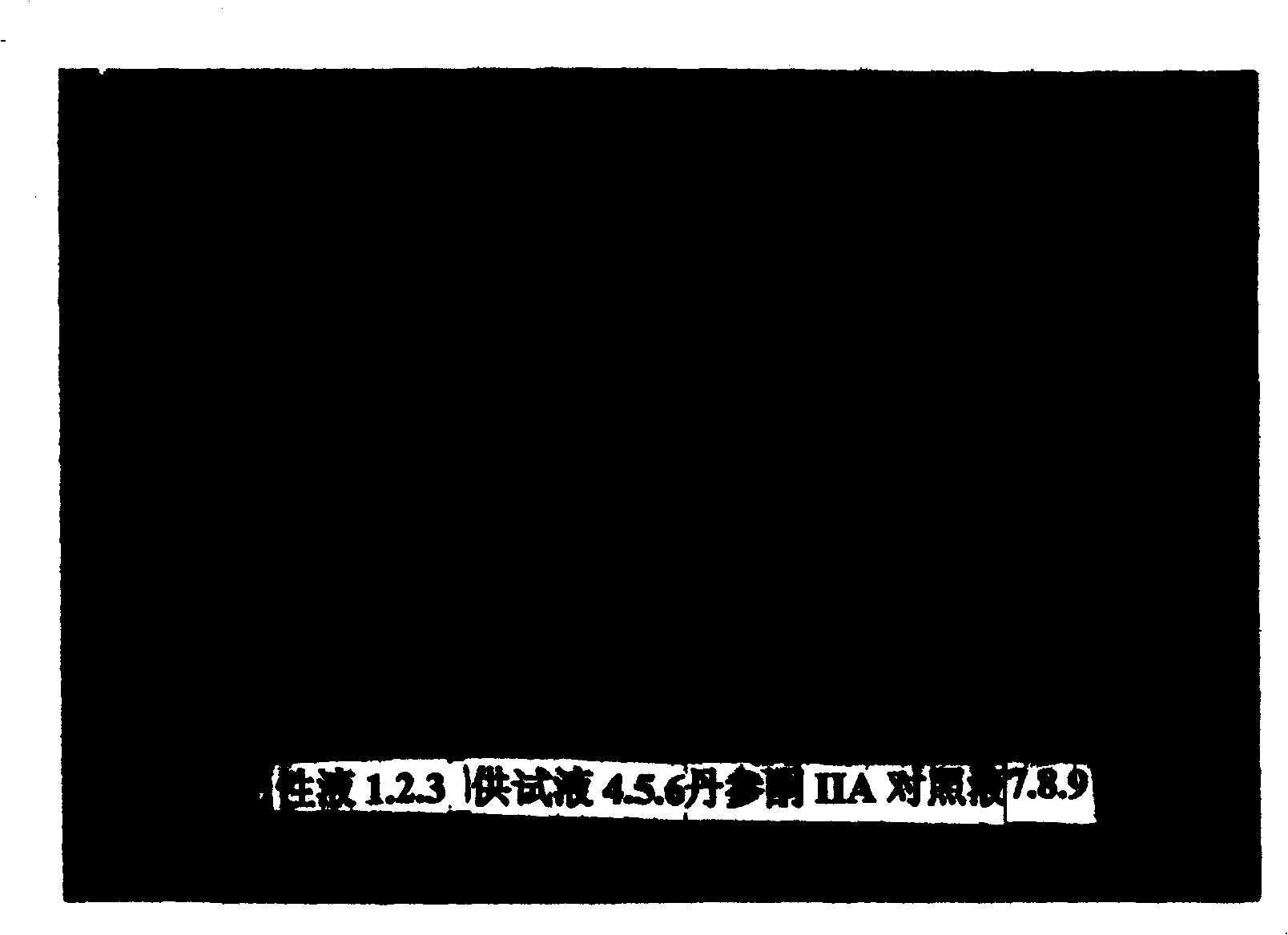 Composition of medicine for treating cerebral arteriosclerosis, and preparation method