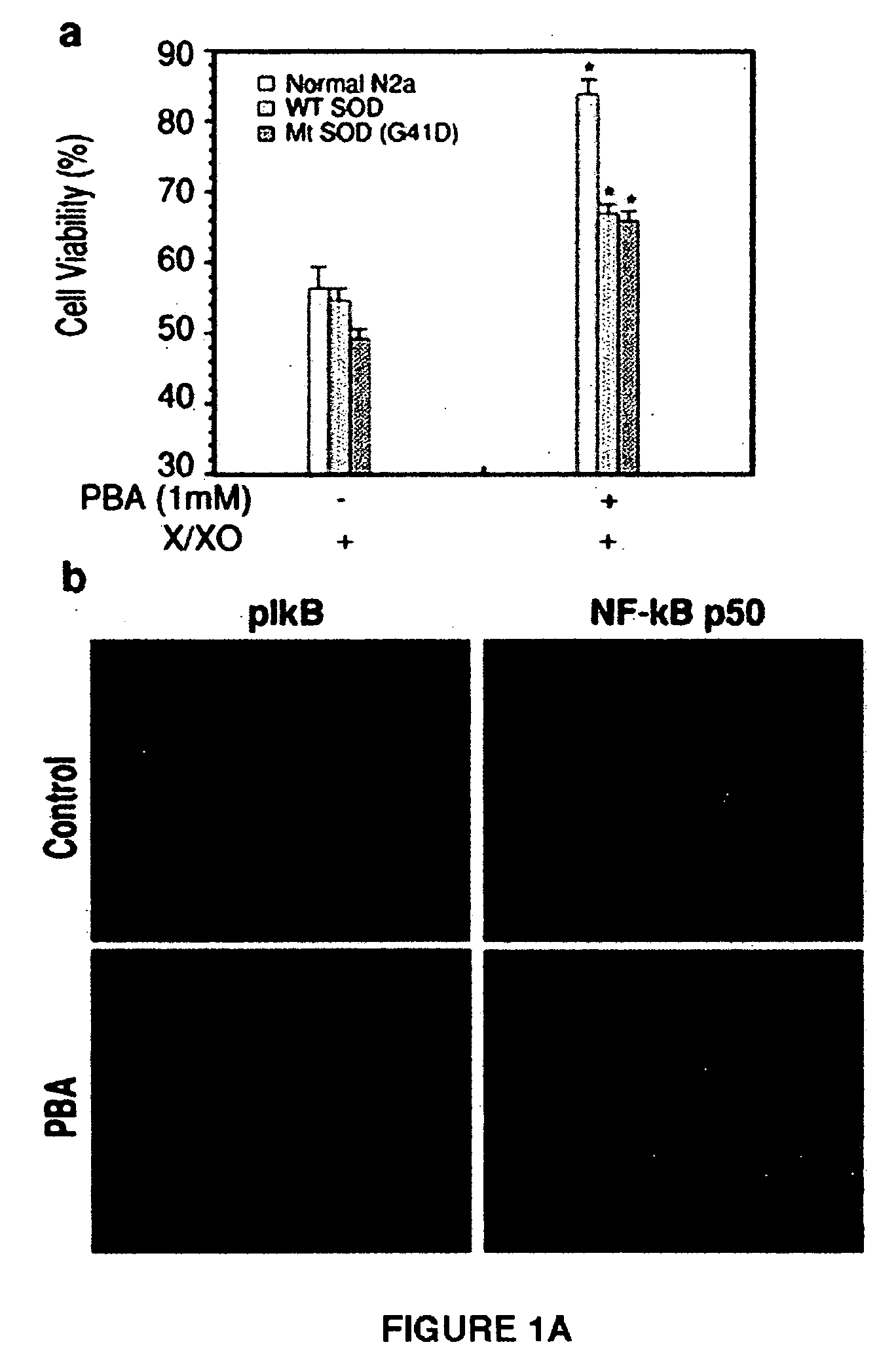 Method of ameliorating or abrogating the effects of a neurodegenerative disorder, such as amyotrophic lateral sclerosis (ALS), by using a HDAC inhibiting agent