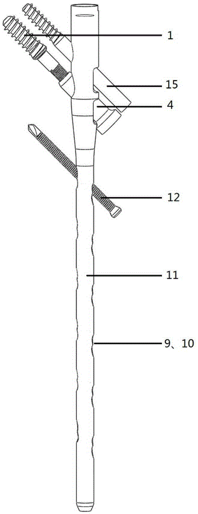 Femoral intramedullary nail device
