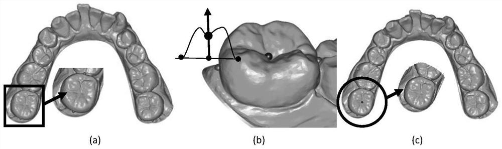 Semi-automatic and accurate segmentation algorithm of dentures and jaws based on sag-aware harmonic scalar field