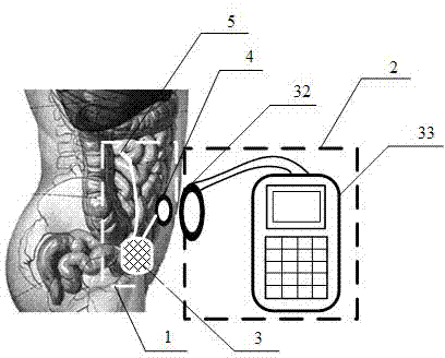 Multifunctional implanted gastrointestinal electrical stimulation system