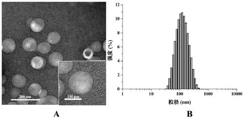 Polypeptide drug-loaded temperature-sensitive liposome and preparation method and application thereof