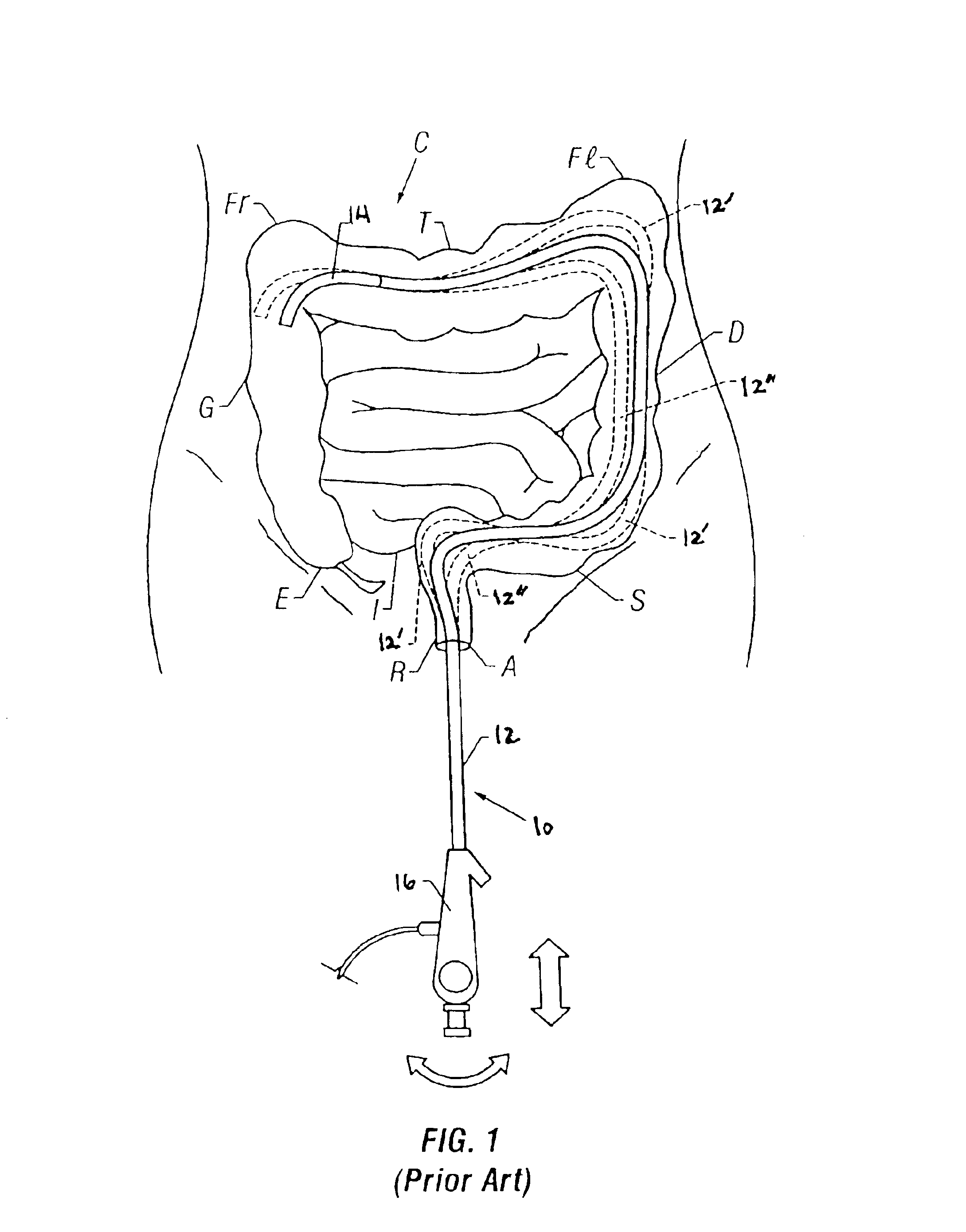 Tendon-driven endoscope and methods of insertion