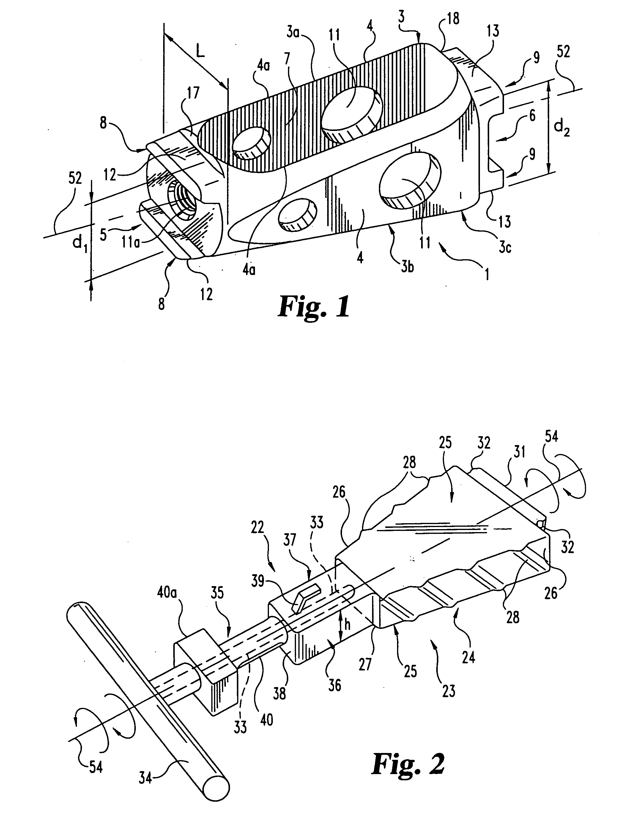 Spinal implant and cutting tool preparation accessory for mounting the implant