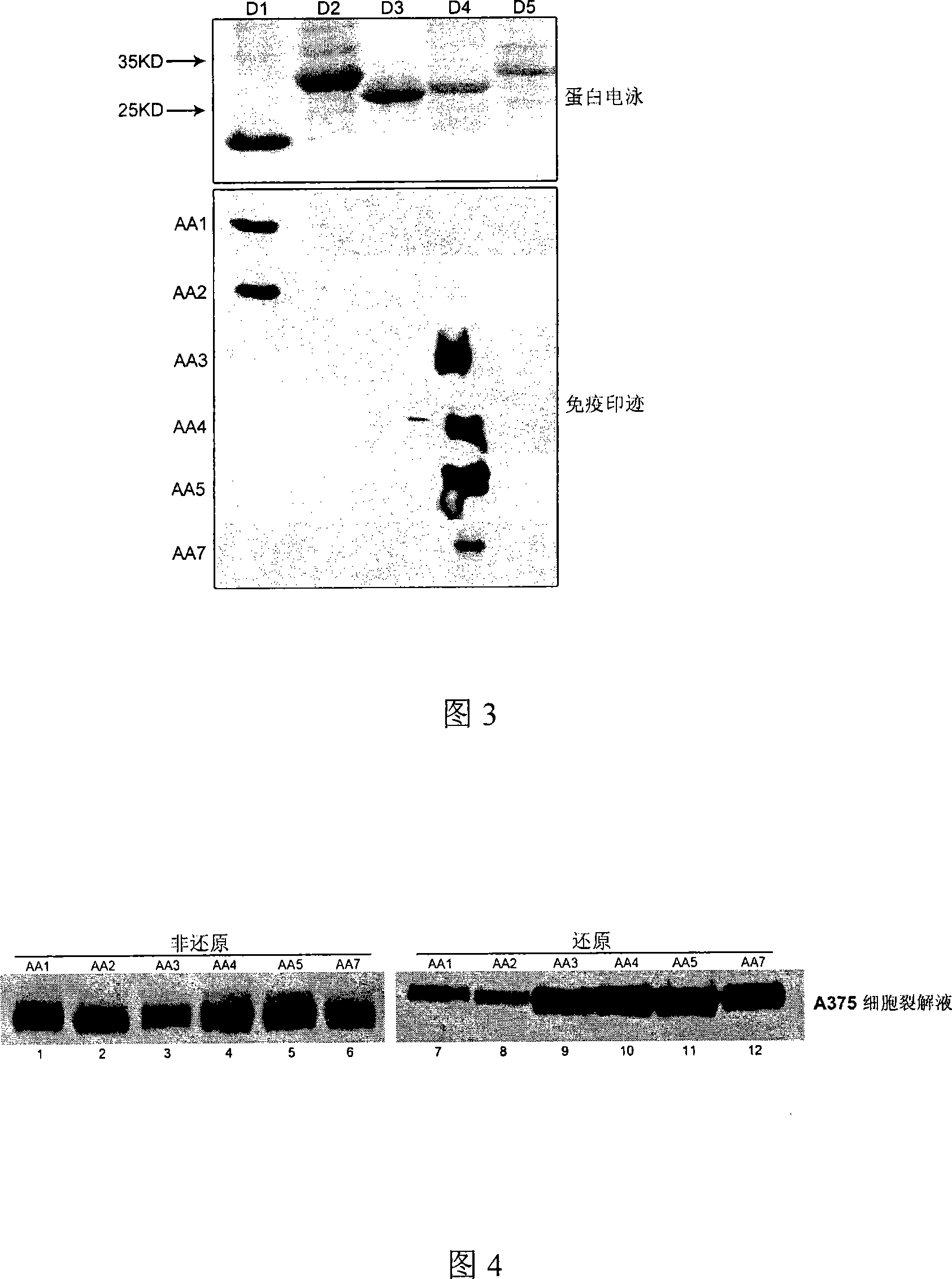 Antihuman CD146 monoclone antibody, composition containing the same, and method for testing dissolubility CD146
