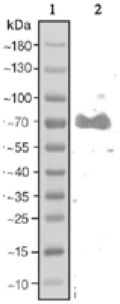 Eukaryotic-expression African swine fever virus p72 antigen and application thereof