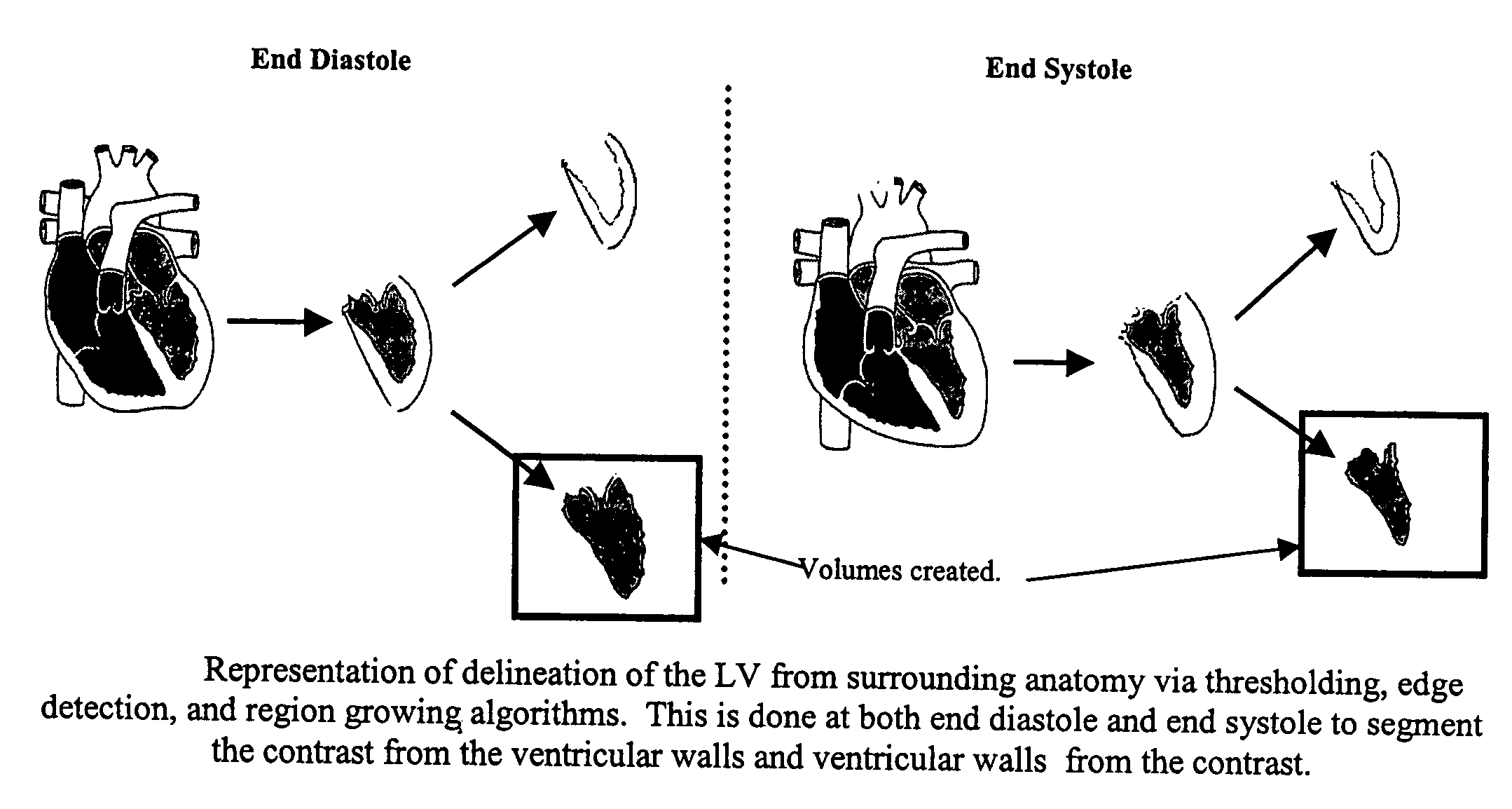 Cardiac display methods and apparatus