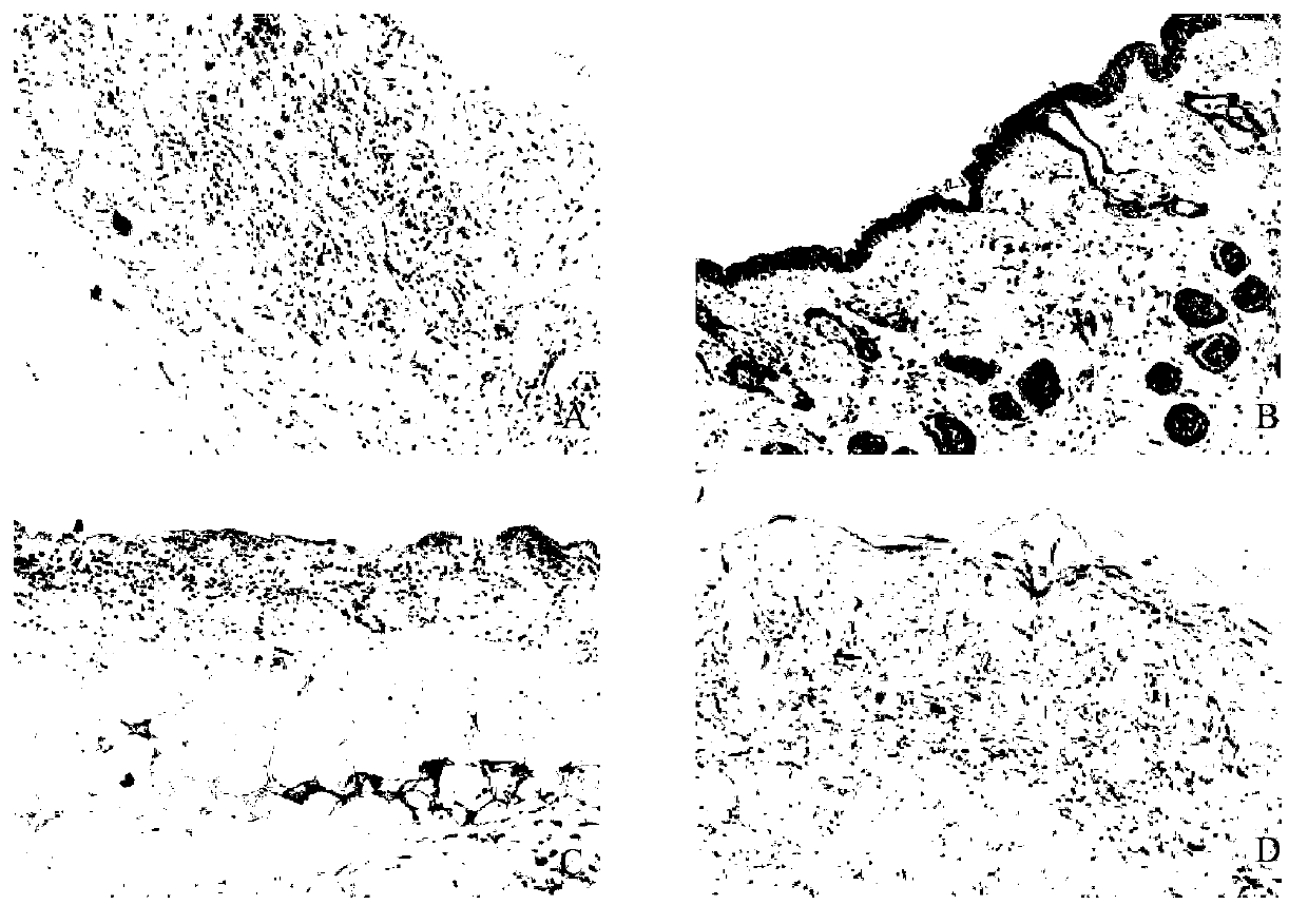 Traditional Chinese medicine composition for preventing and treating chemotherapeutic extravasation injury and preparation method and application thereof