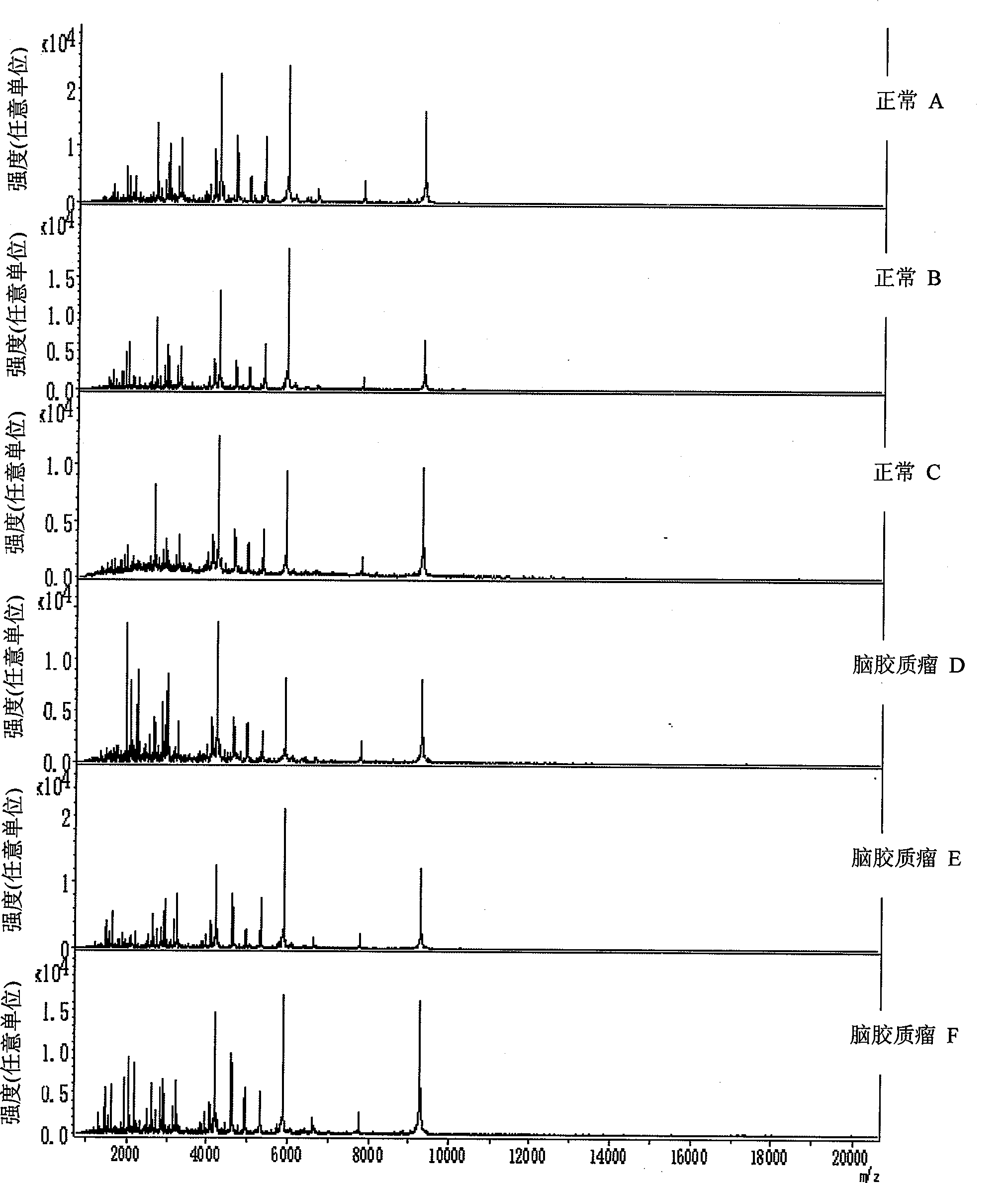 Mass spectrogram model for detecting brain glioma characteristic and preparing method thereof