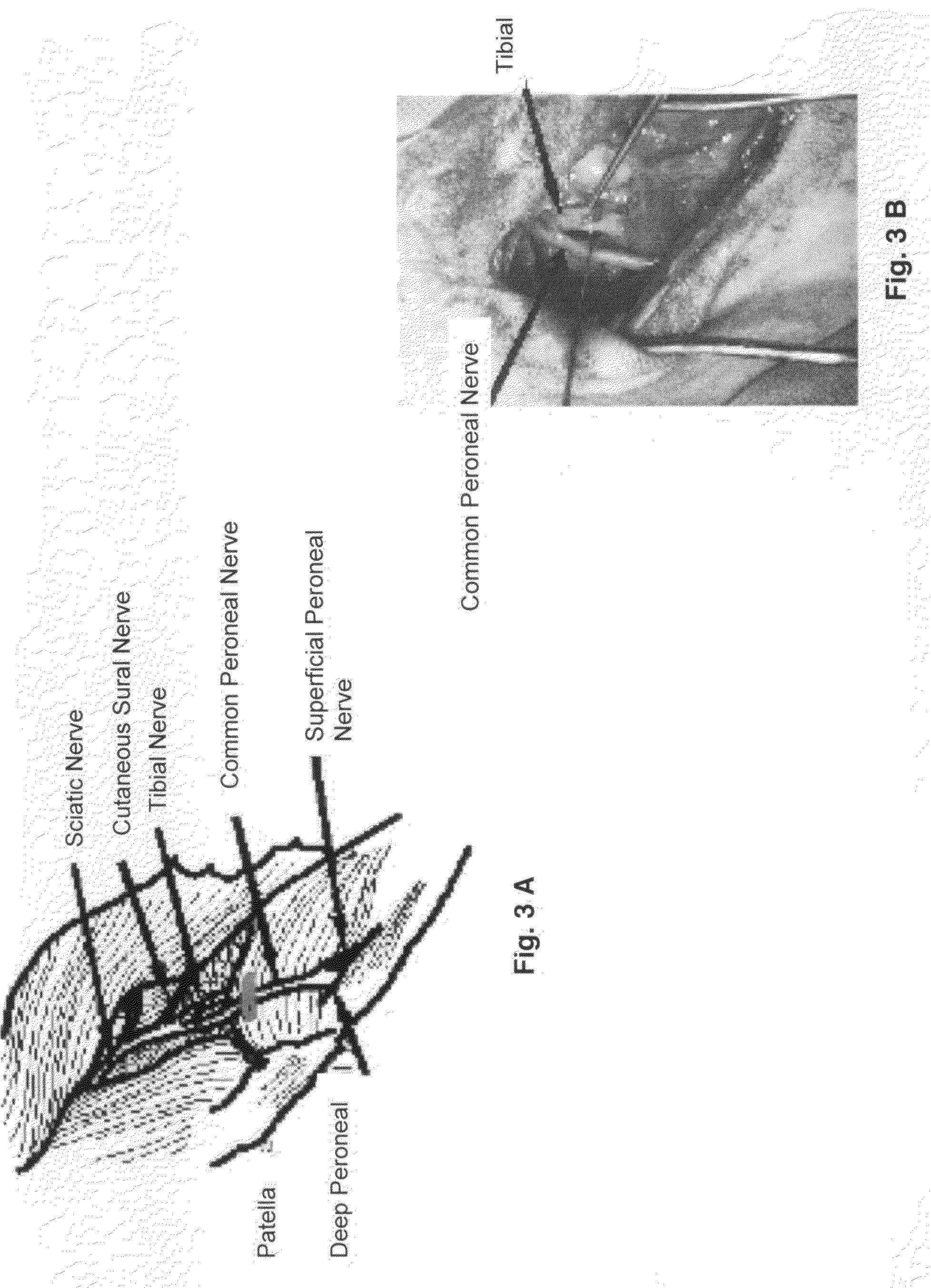 Model of experimentally induced chronic pain and uses thereof