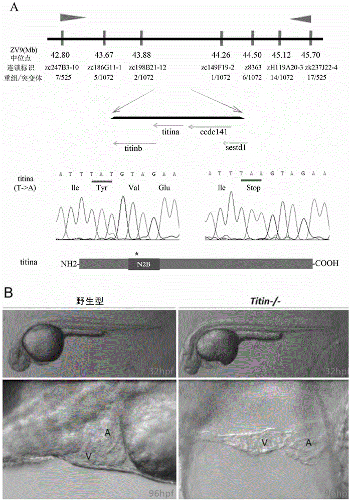 Establishment and application of dilated cardiomyopathy zebrafish disease model