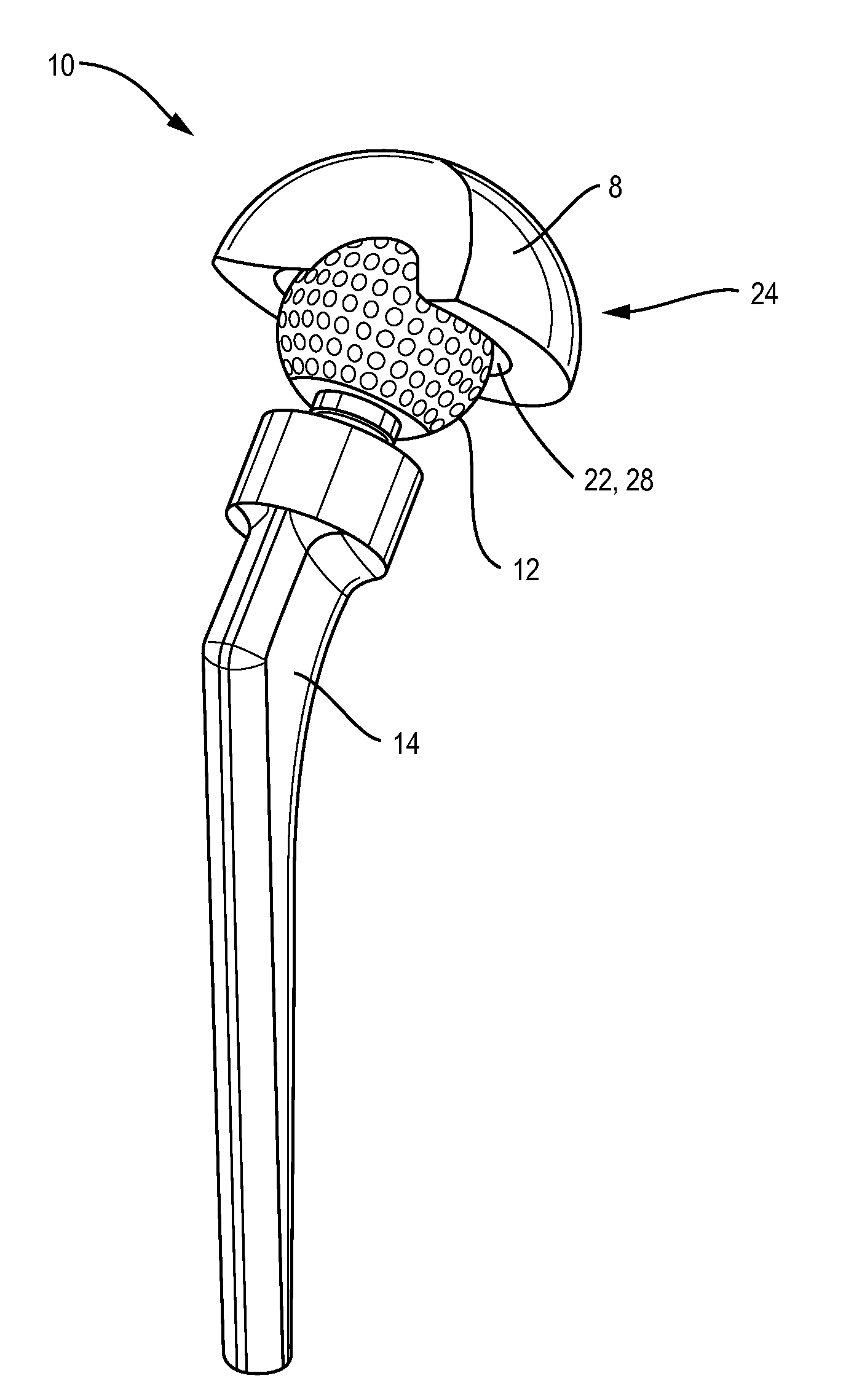 Extended life prosthetic hip joint