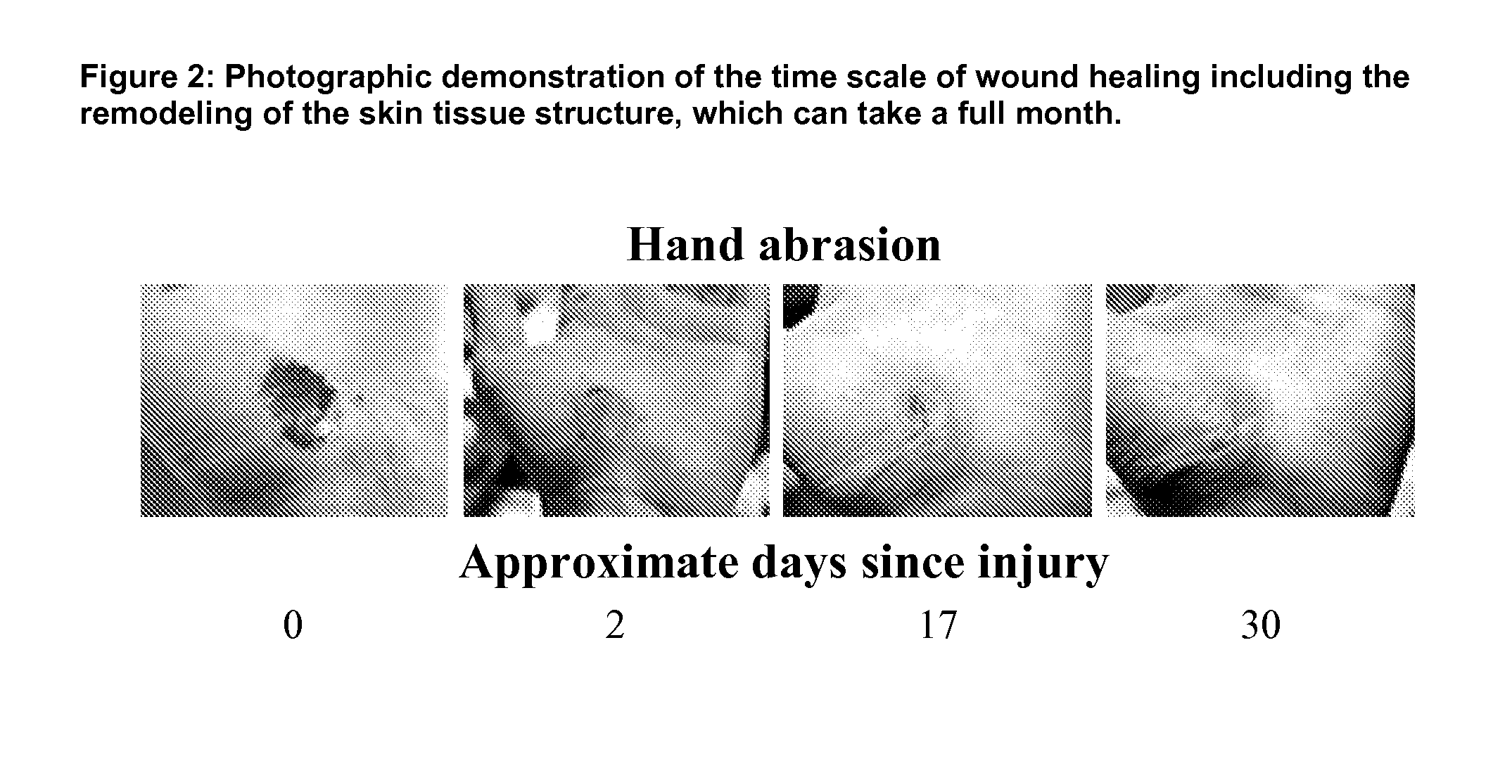 Use of tetracycline compositions for wound treatment and skin restoration